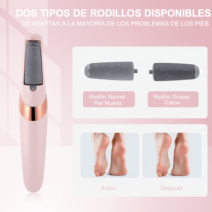 ✨ Removedor Eléctrico de Callos® – Pies Suaves en Minutos, Sin Dolor
