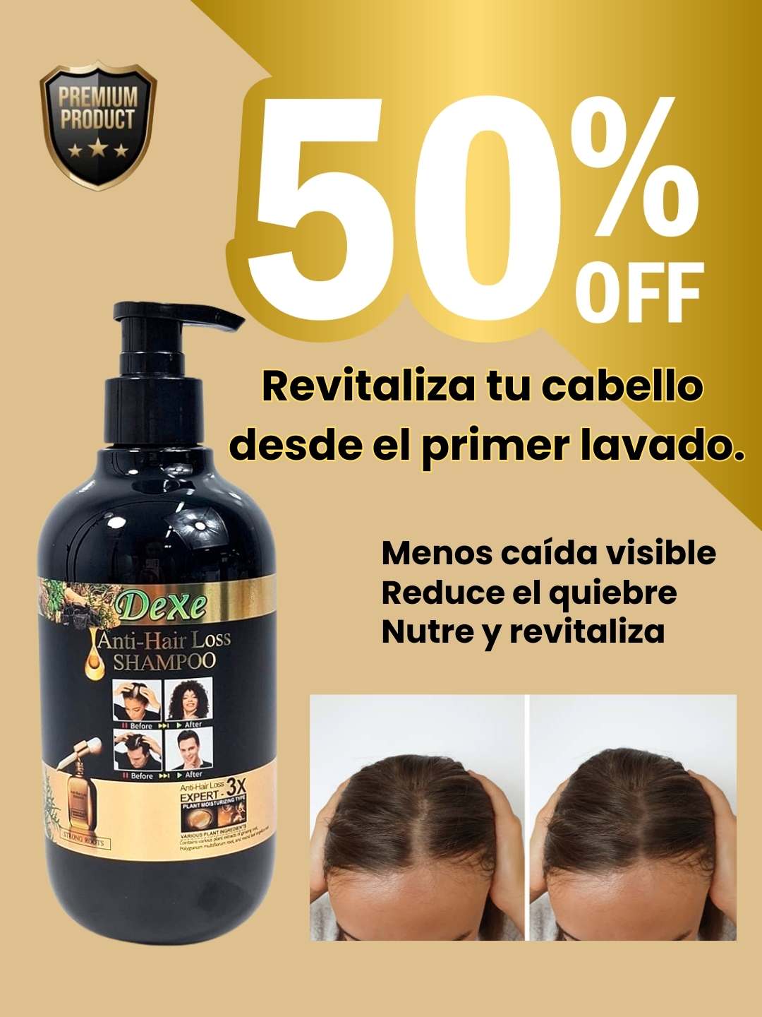 Shampoo Anticaída Dexe Premium®  - 🔥Frena la caída. Recupera tu fuerza.